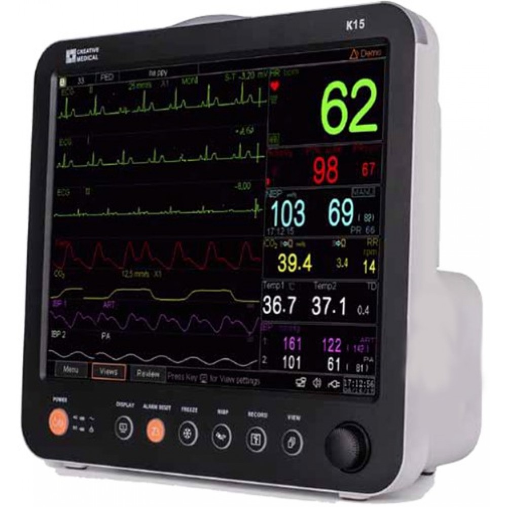 Touchscreen da 8 pollici + monitor paziente portatile EtCO2: tiene traccia  dei parametri vitali tra cui ECG, RESP, NIBP, saturazione di ossigeno,  frequenza cardiaca, temperatura ed Etco2. – Wellue